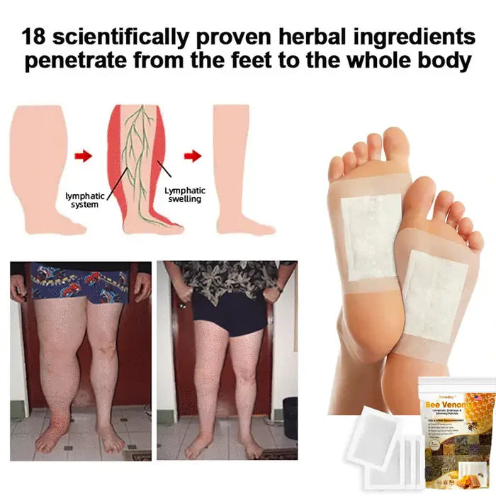 Bee Venom Lymphatic & Sliming Patches (25 Patches)